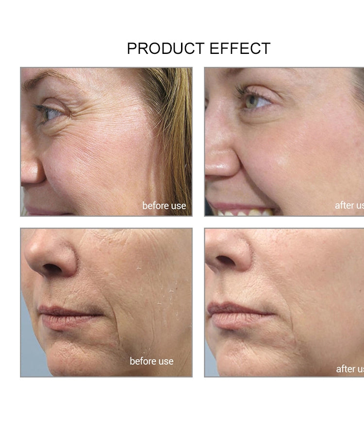 OEM cosmético de la fábrica de la fábrica del extracto de la vitamina C de la cara modificado para requisitos particulares