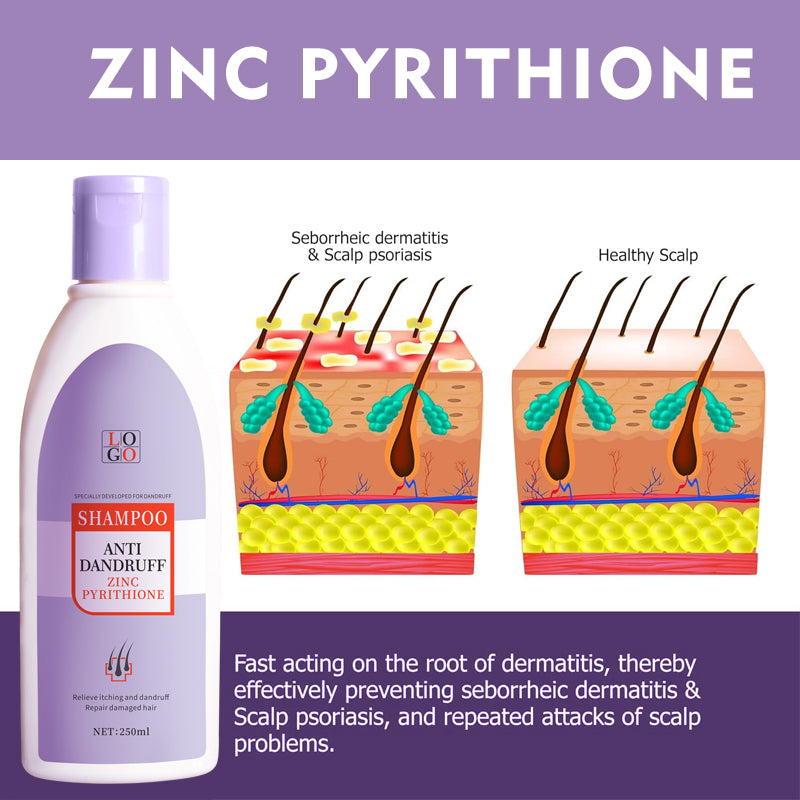 Planta de procesamiento de champú anticaspa con zinc piritiona OEM