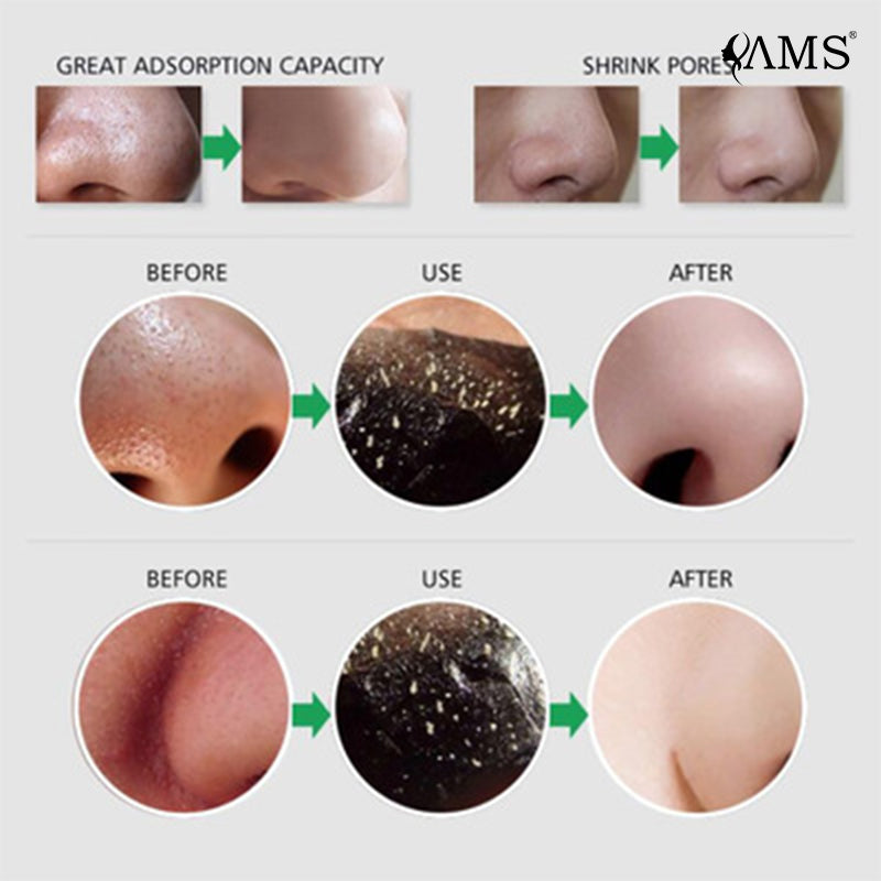 Fabricación de mascarillas exfoliantes de carbón negro y procesamiento OEM ODM