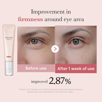 Fabricante OEM de crema para ojos con retinol | Cuidado antiedad para ojos de marca privada